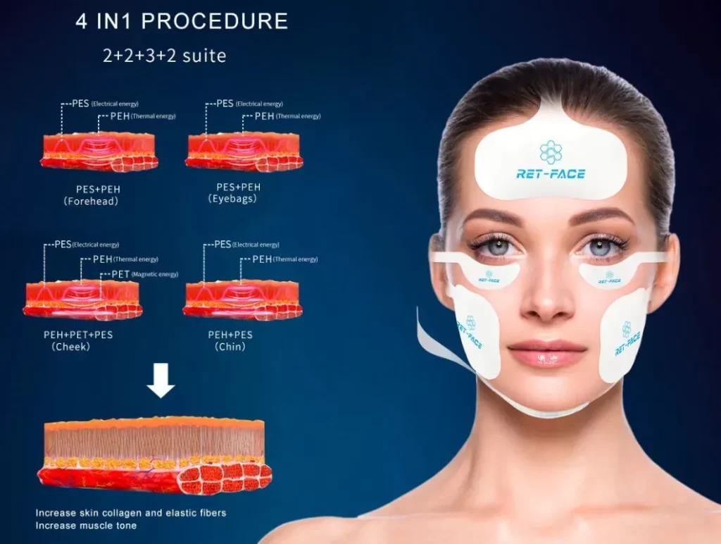 Emface Rf Muscle Stimulation Face Sculpting Beauty Machine